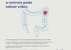 Médicos alertam para a importância do diagnóstico precoce do Cancro Colorretal
