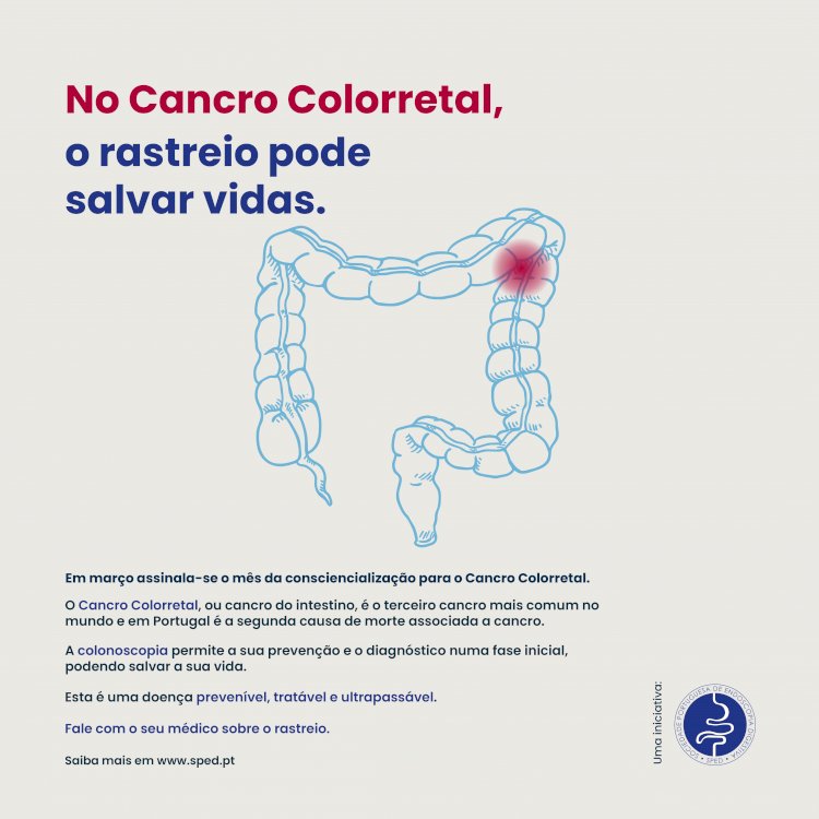 Médicos alertam para a importância do diagnóstico precoce do Cancro Colorretal